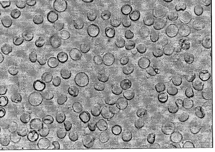 Globules rouges redevenus ronds au microscope